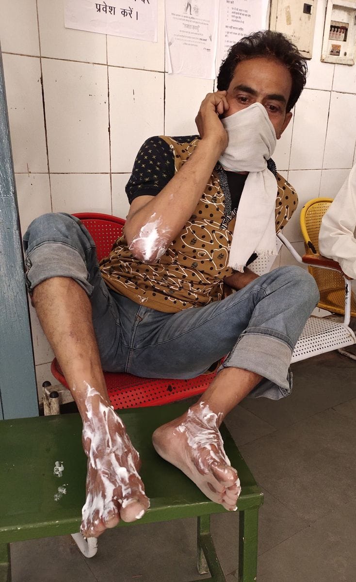 Leaked lpg gas cylinder catches fire, three injured.
