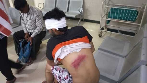 Due to Corona virus, a man guarding the naco in Indergarh was attacked with sticks with sticks