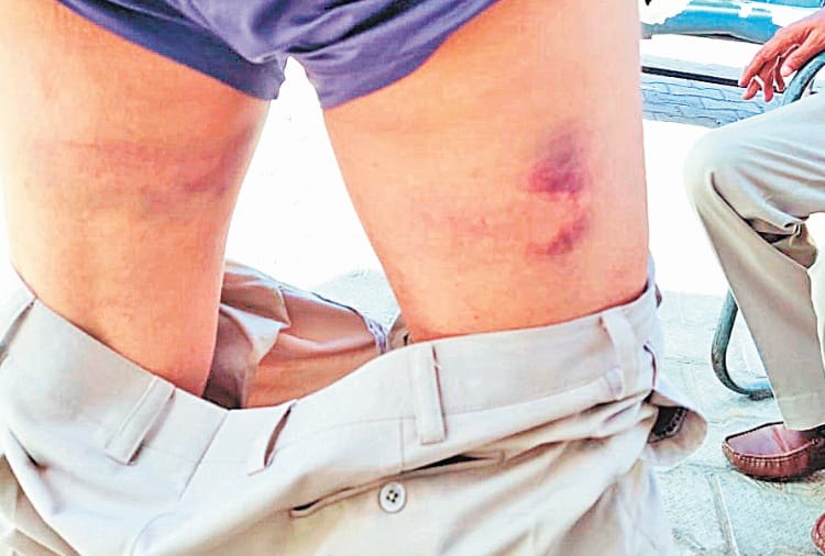 Coronavirus, Lockdown, Haryana Roadways Driver Beaten by UP Police