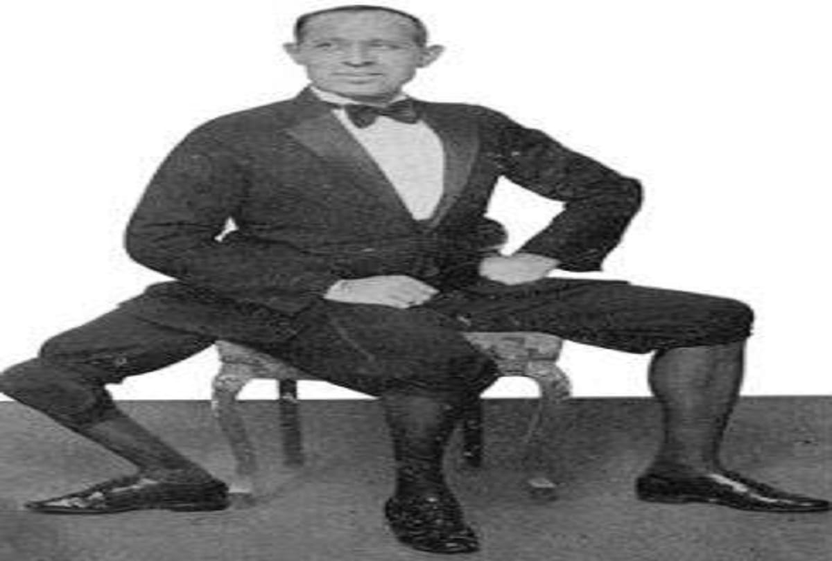 Three legged man Frank Lentini Interesting story of a Strange person