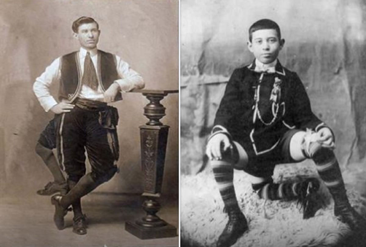 interesting story of three legged man frank lentini