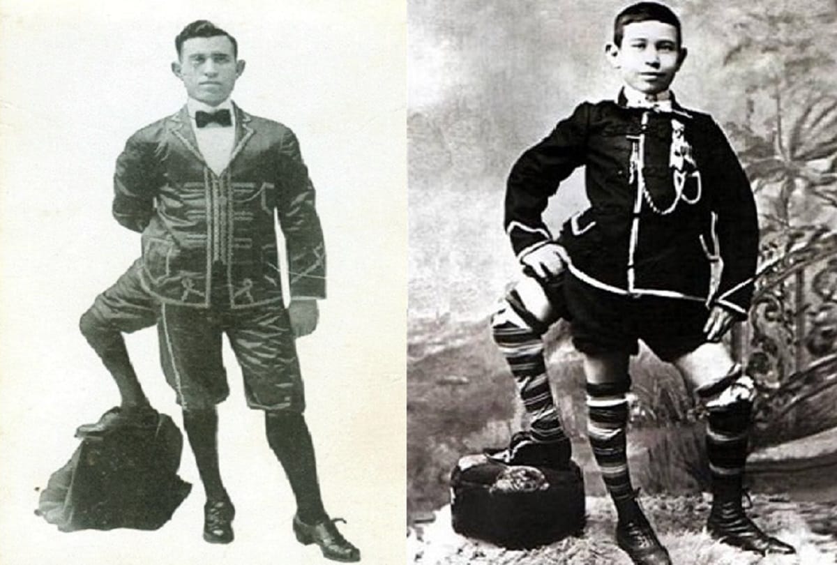 interesting story of three legged man frank lentini