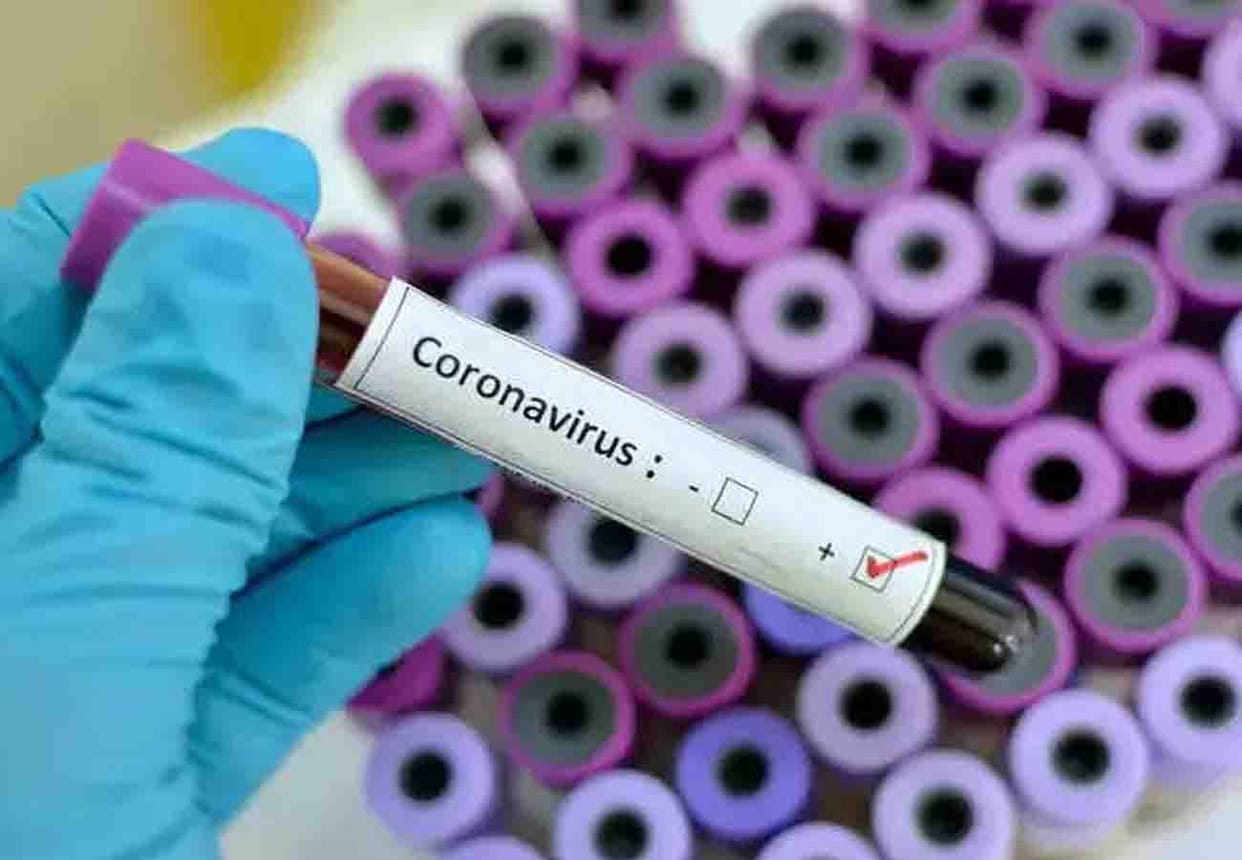 Coronavirus five new cases in gurugram after one week including one jamaati