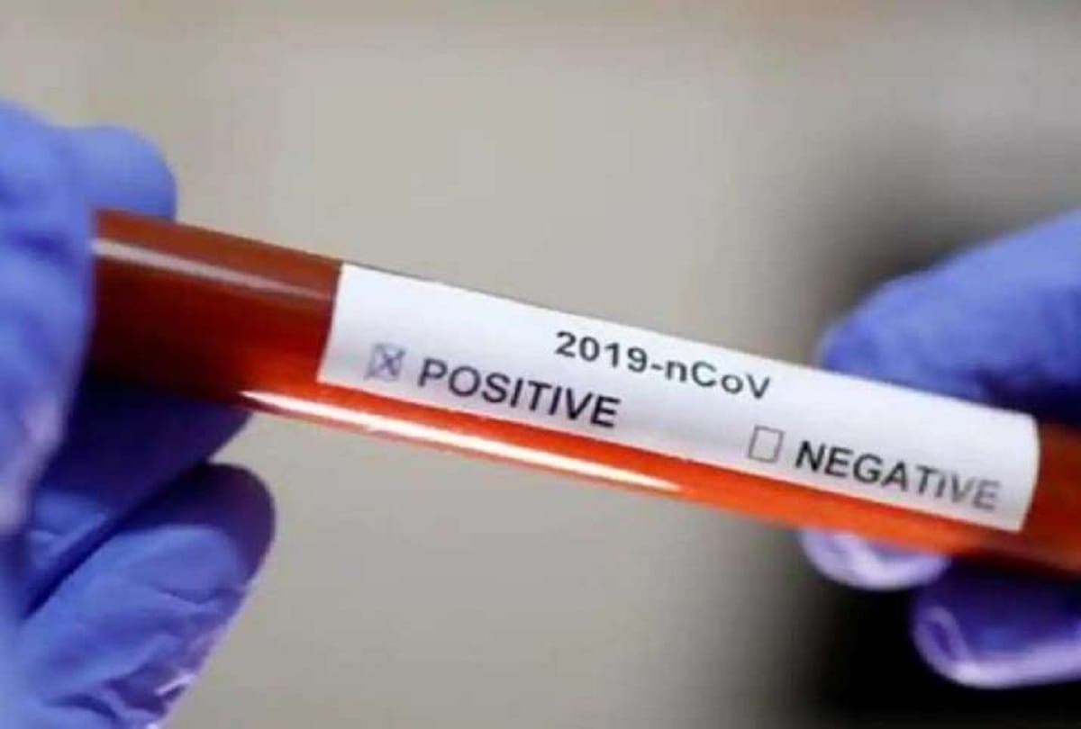 Coronavirus in world, Antiparasite drug kills corona virus in 48 hours in melbourne