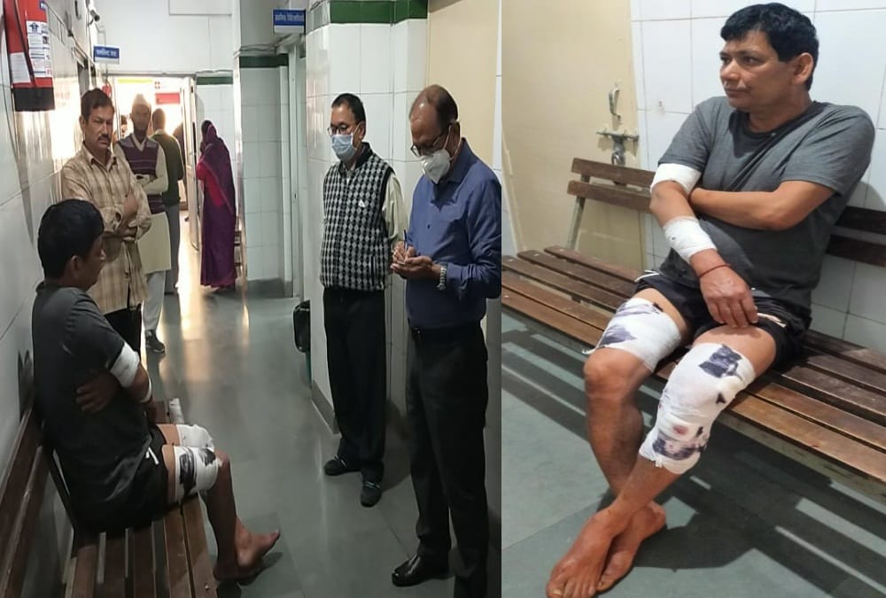 Leopard Attack on Two Youth In Almora, Both badly Injured