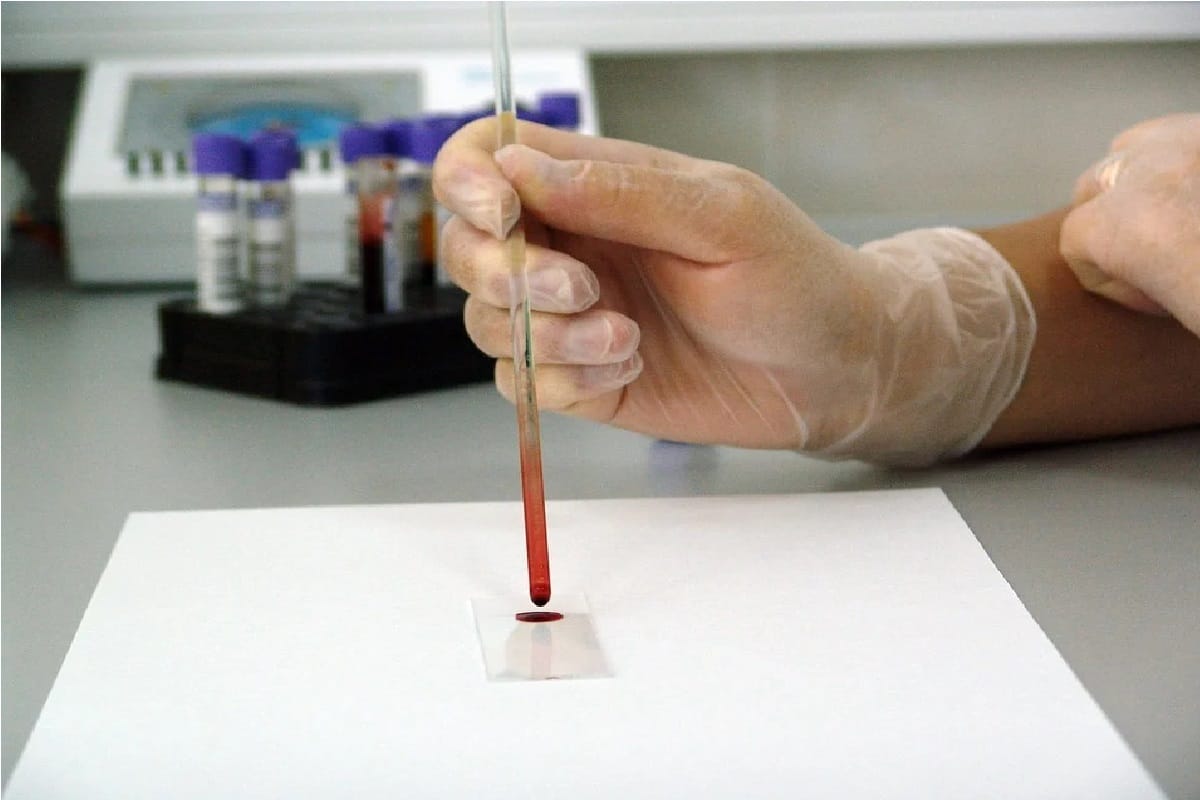 difference between antibodies made after infection and vaccination