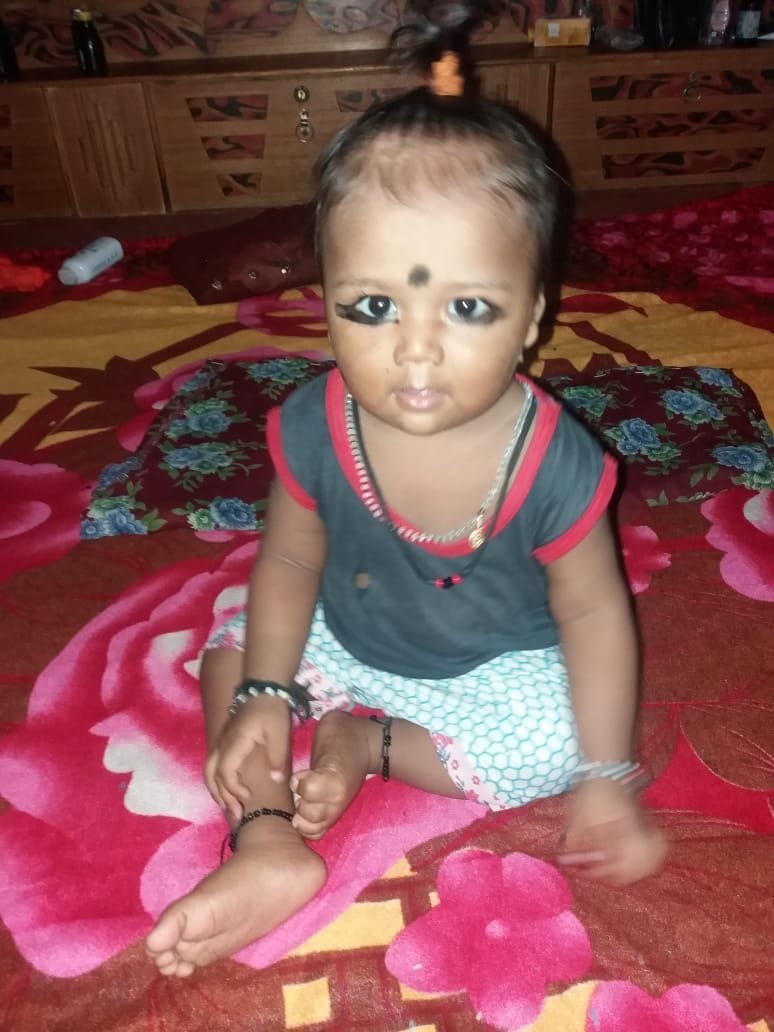 boiled milk fell on child died