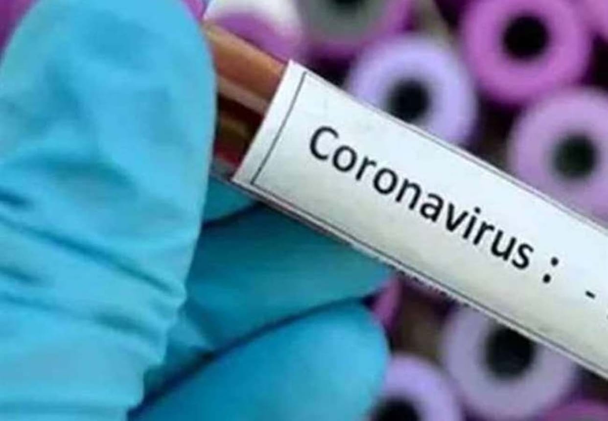 Coronavirus, Lockdown, Curfew, Chandigarh Health Bulletin