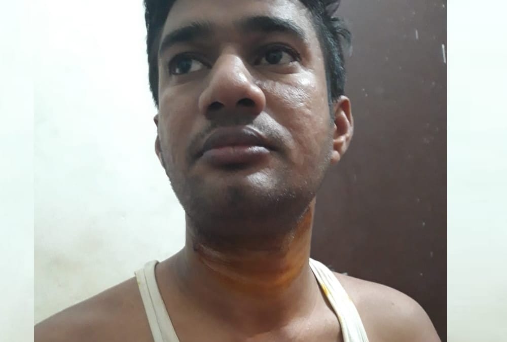 sipahi Injured due to manjha in lucknow