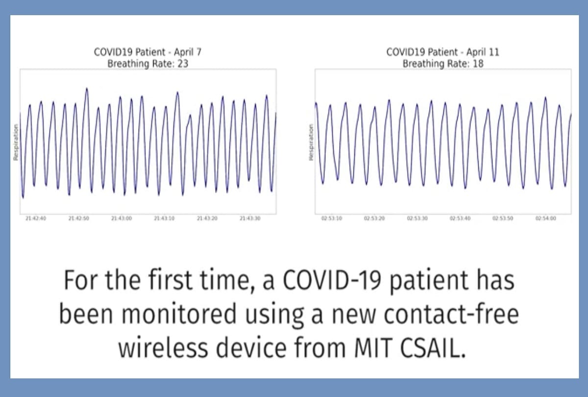 American Scientist develop a wireless device to detect COVID-19 patients movement and breathing at home