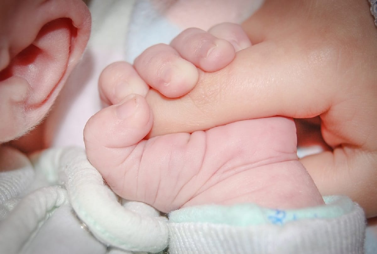 Iraq first baby in the world which born with 3 penises