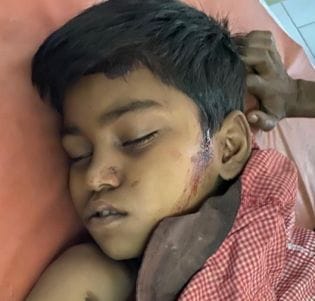 Attempted to kidnap child, stabbed in head