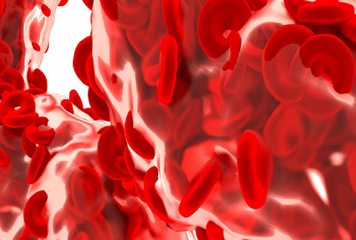 Smartphone will detect hemoglobin levels by looking at the picture of the eyelids
