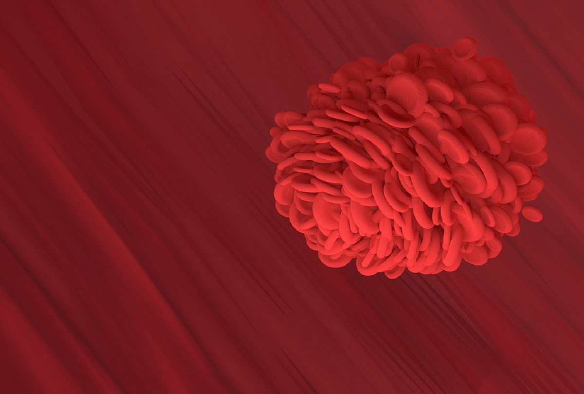 World Asthma Day too much iron in body causes asthma