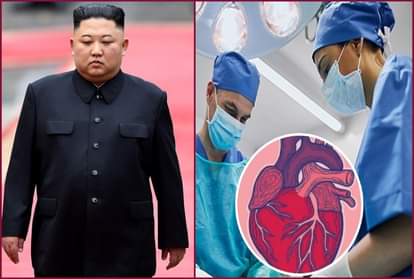 किम जोंग उन के गंभीर रूप से बीमार होने की खबरें आ रही हैं