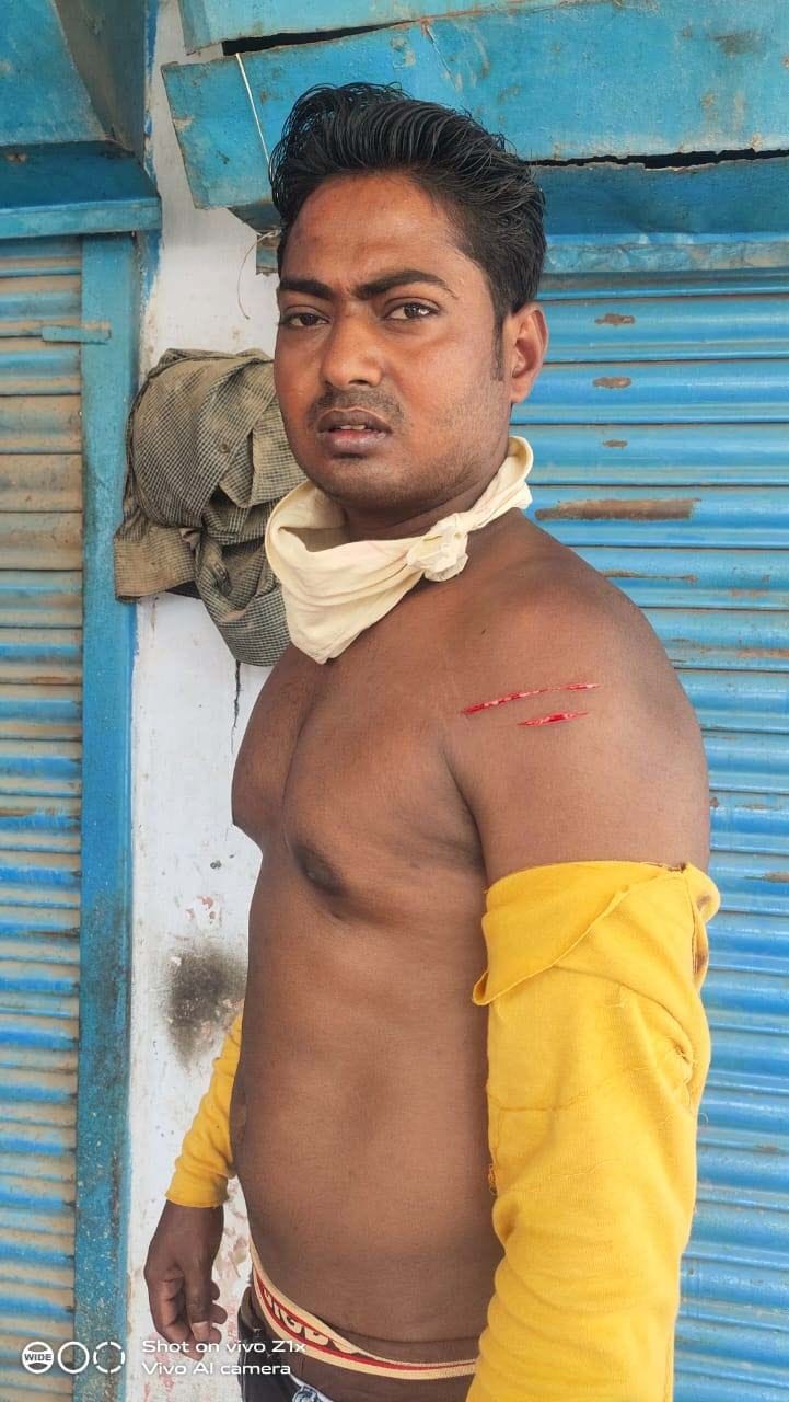 on the opposition of bad touch people did the  assault