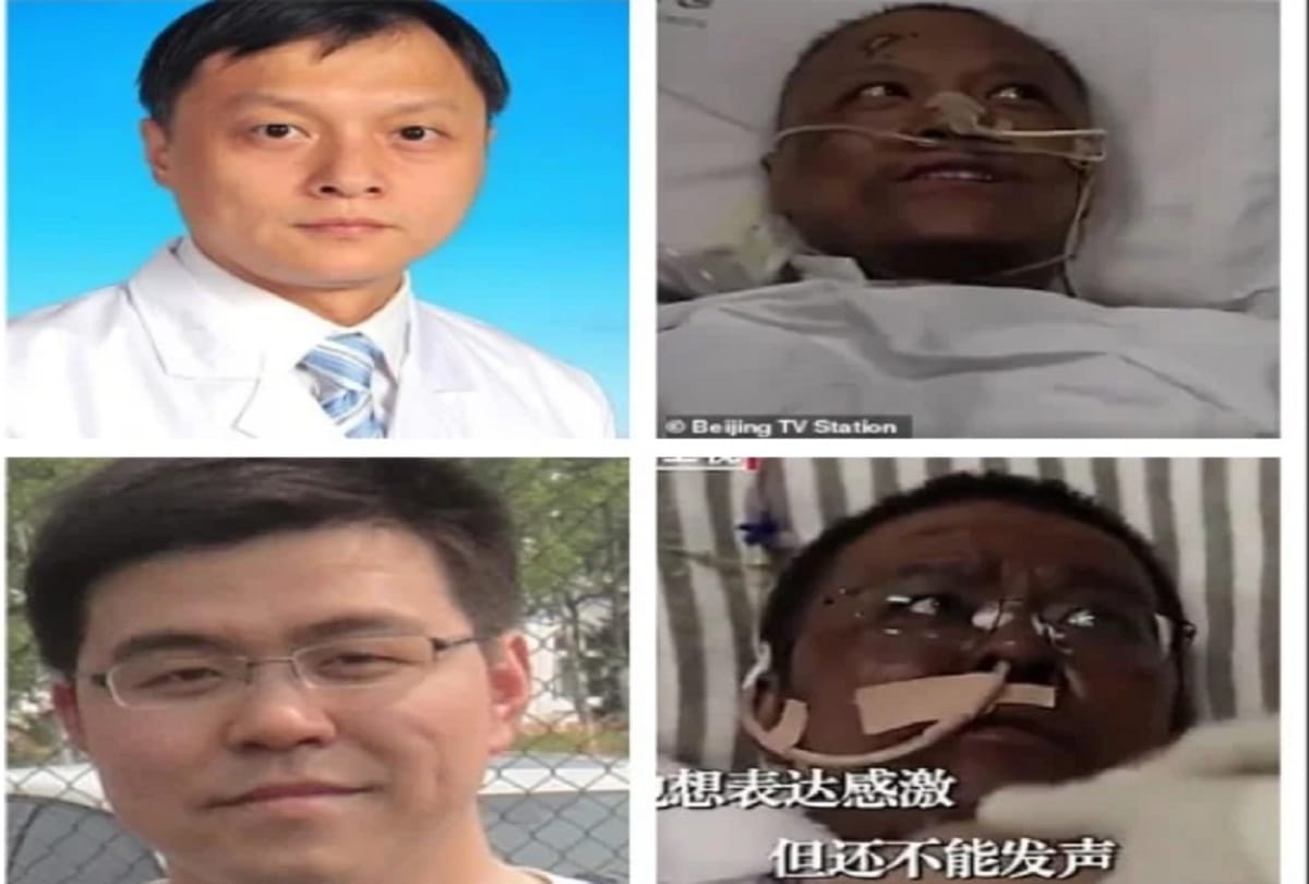 chinese doctor critically ill covid 19 wake darkened skin