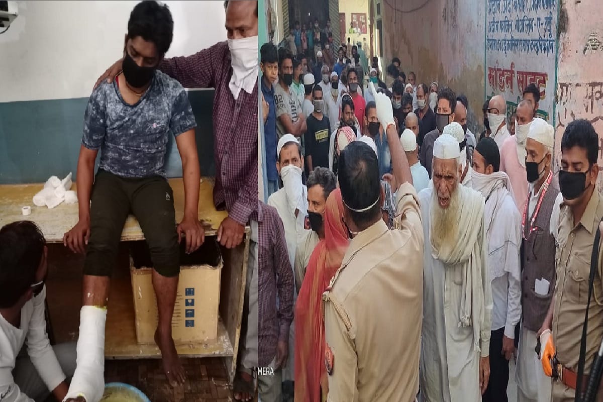 Lockdown in Uttar Pradesh, A young man broke his leg from police beating in Muzaffarnagar