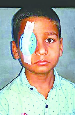 Student's eye got injured due to firing in Harsh firing