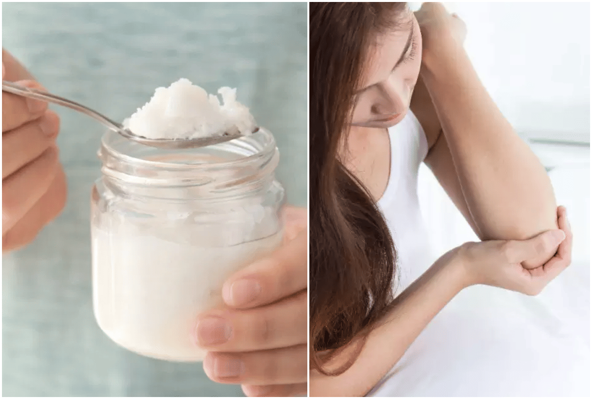 4 ways to get rid of dark elbows overnight