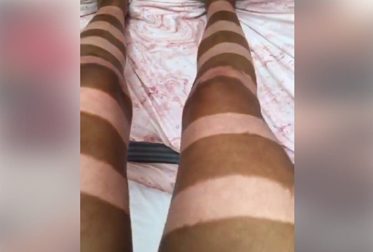 Bored woman gives herself a bizarre stripy fake tan makeover by using sellotape in lockdown