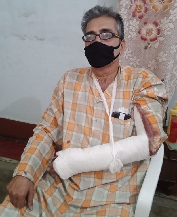 police accused of breaking hands