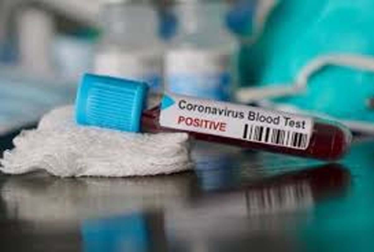 Corona cases increases: Private nursing homes are also being prepared for infected patients in Jammu and Kashmir