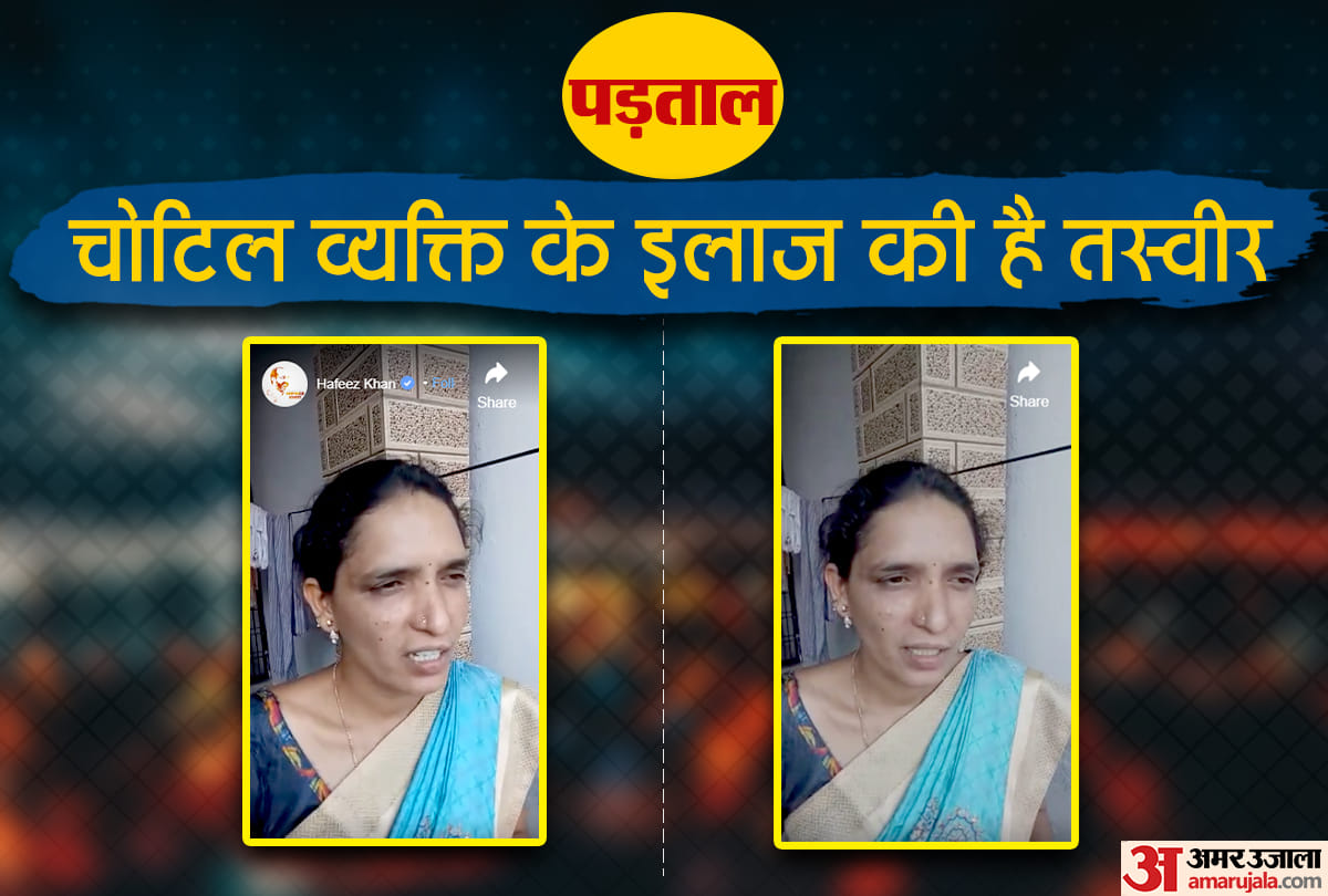 Nurse was not washing imam feet, she just treating him, know about fake viral video