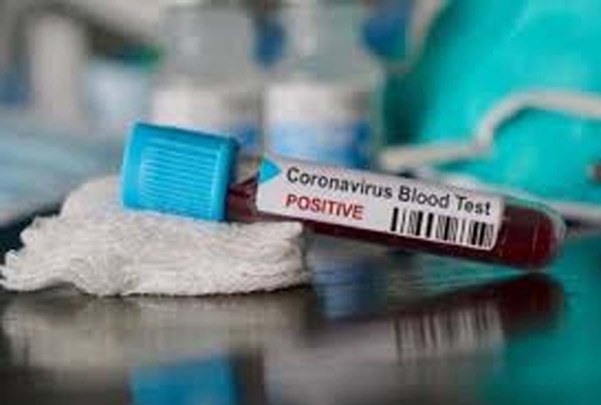 Madhya Pradesh Coronavirus Live Updates total Covdi 19 case