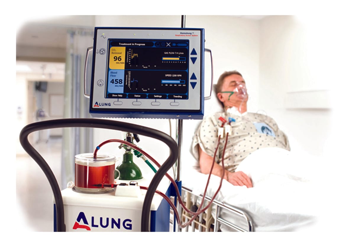 Coronavirus Case News In Hindi : Hemolung Respiratory Device will save the lives of serious corona patients