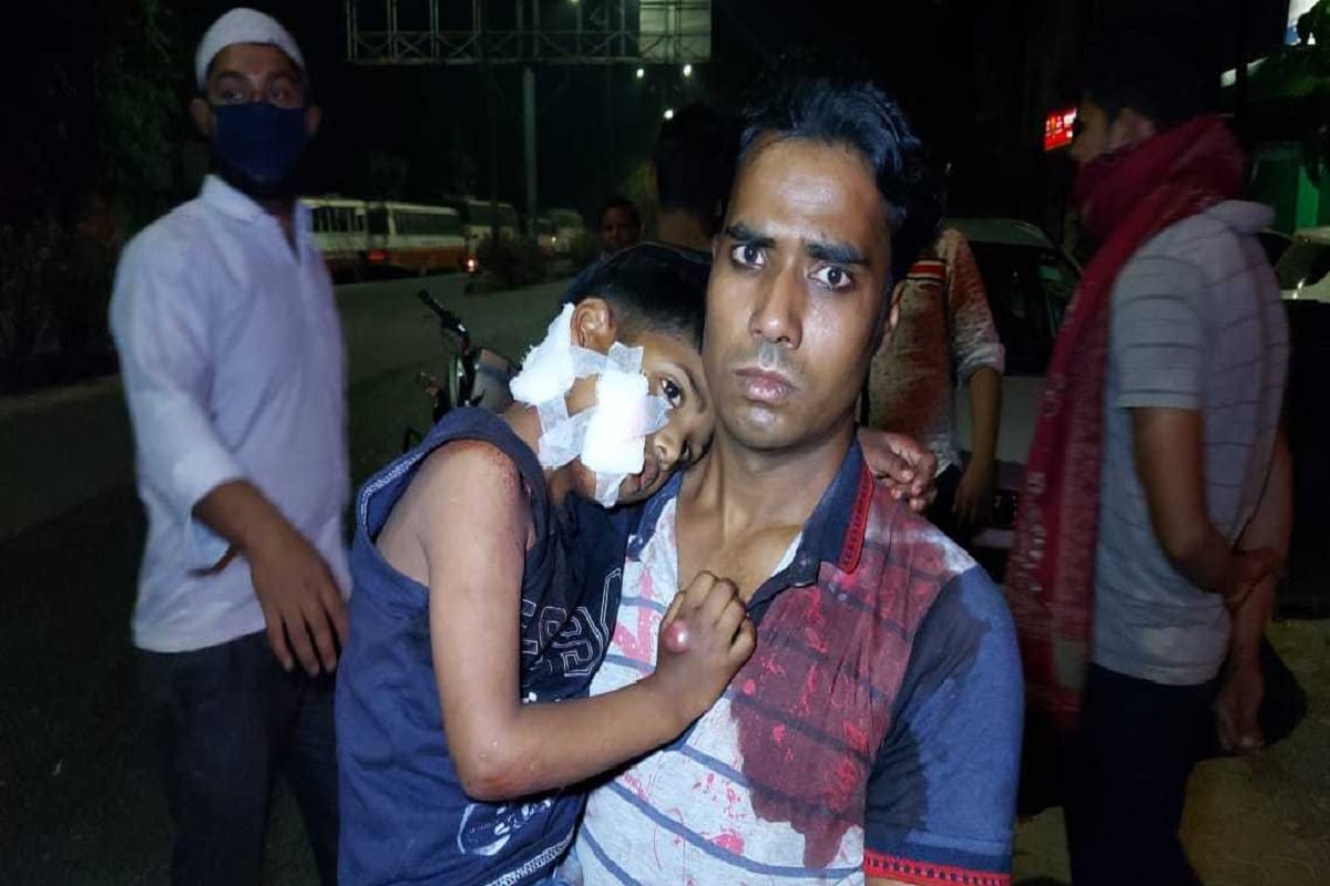 Conflict in two parties of girlfriends dispute and two people get shot in Meerut