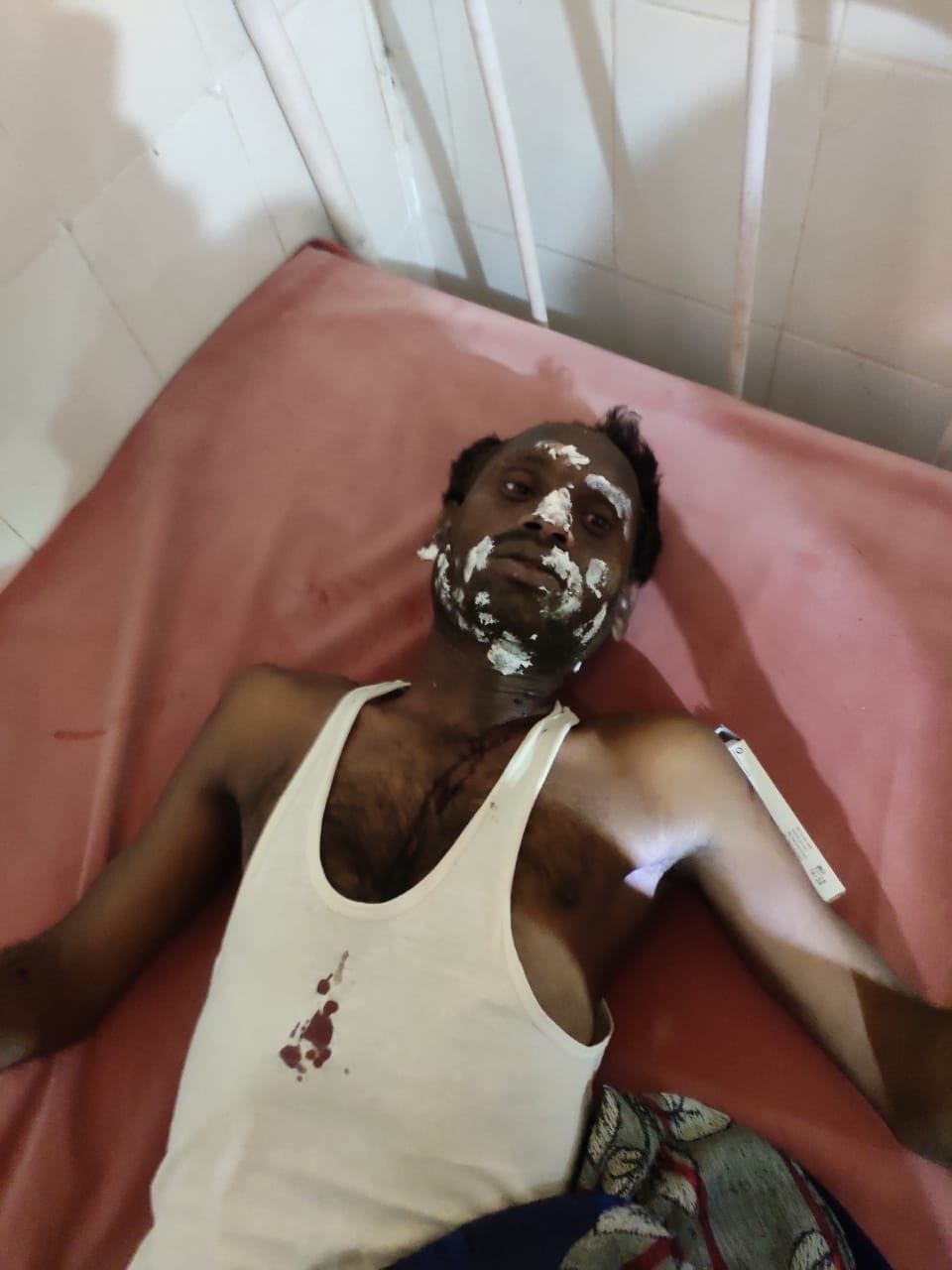 Leakage gas cylinder fire, three houses damaged, seven people scorched