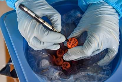 showing better effect of combination of antiviral drugs in the treatment of kovid-19: study