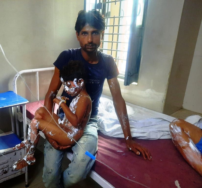 Gas cylinder caught fire, seven scorched children including