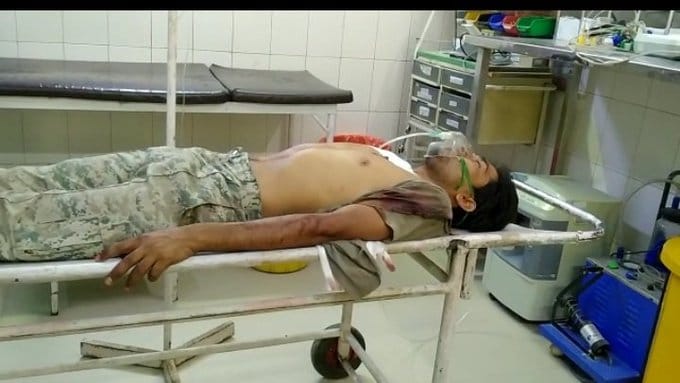 person injured by firing