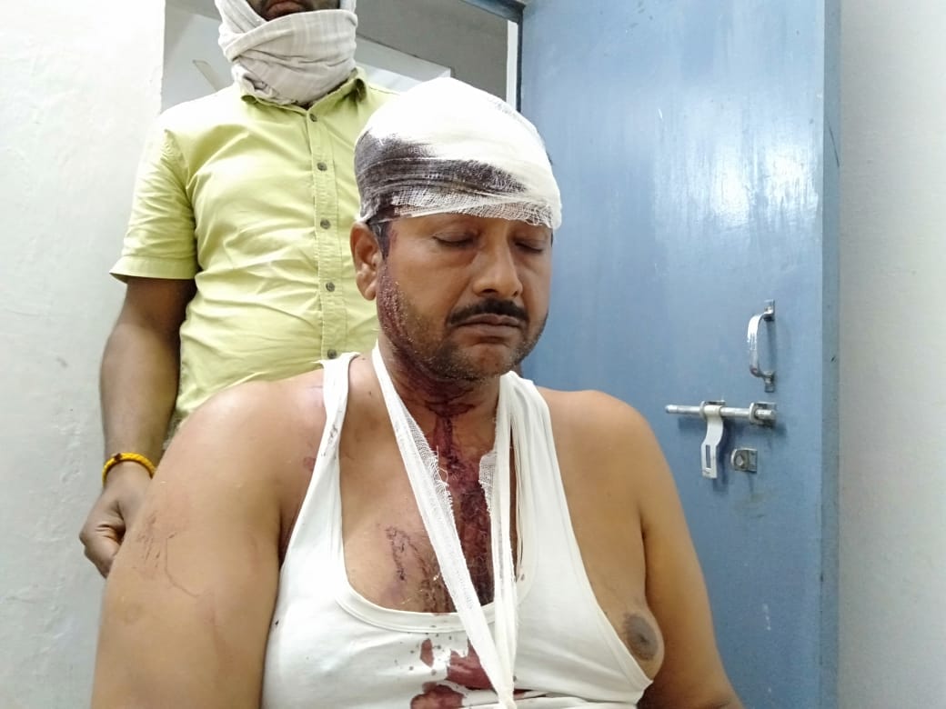 Deadly attack on BJP district vice-president in land dispute in jaunpur