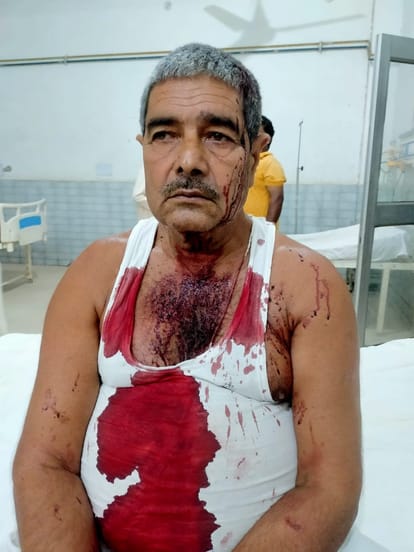 Bloody clash between two parties over Panchayat elections in Mau