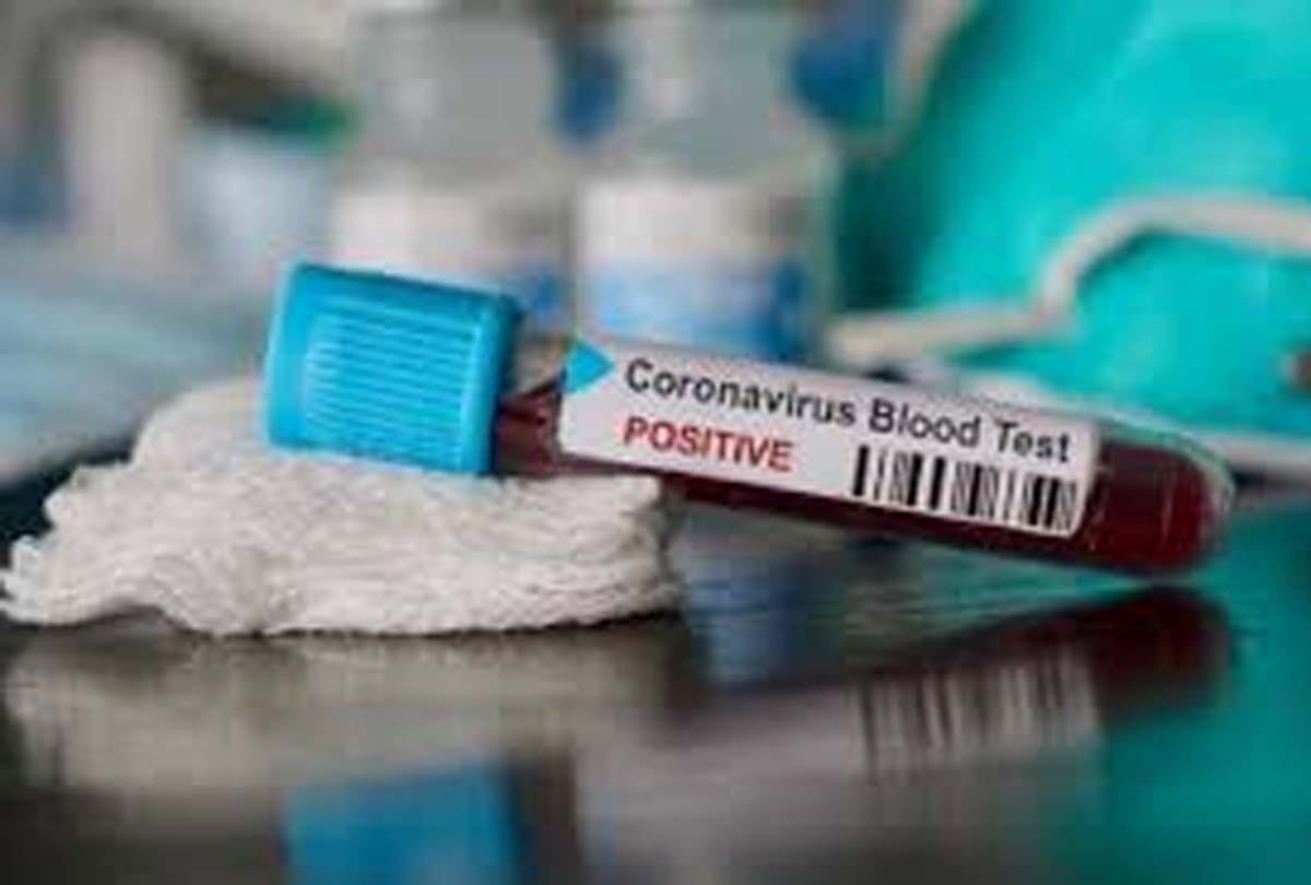 A Government employee who was Covid-19 infection tried to escape from Hospital IN SRINAGAR
