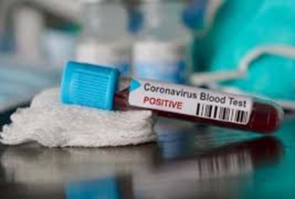 coronavirus can infected by sexual relationship claimed in research