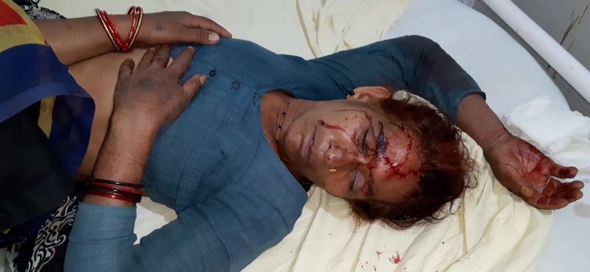 Five peole injured to fight