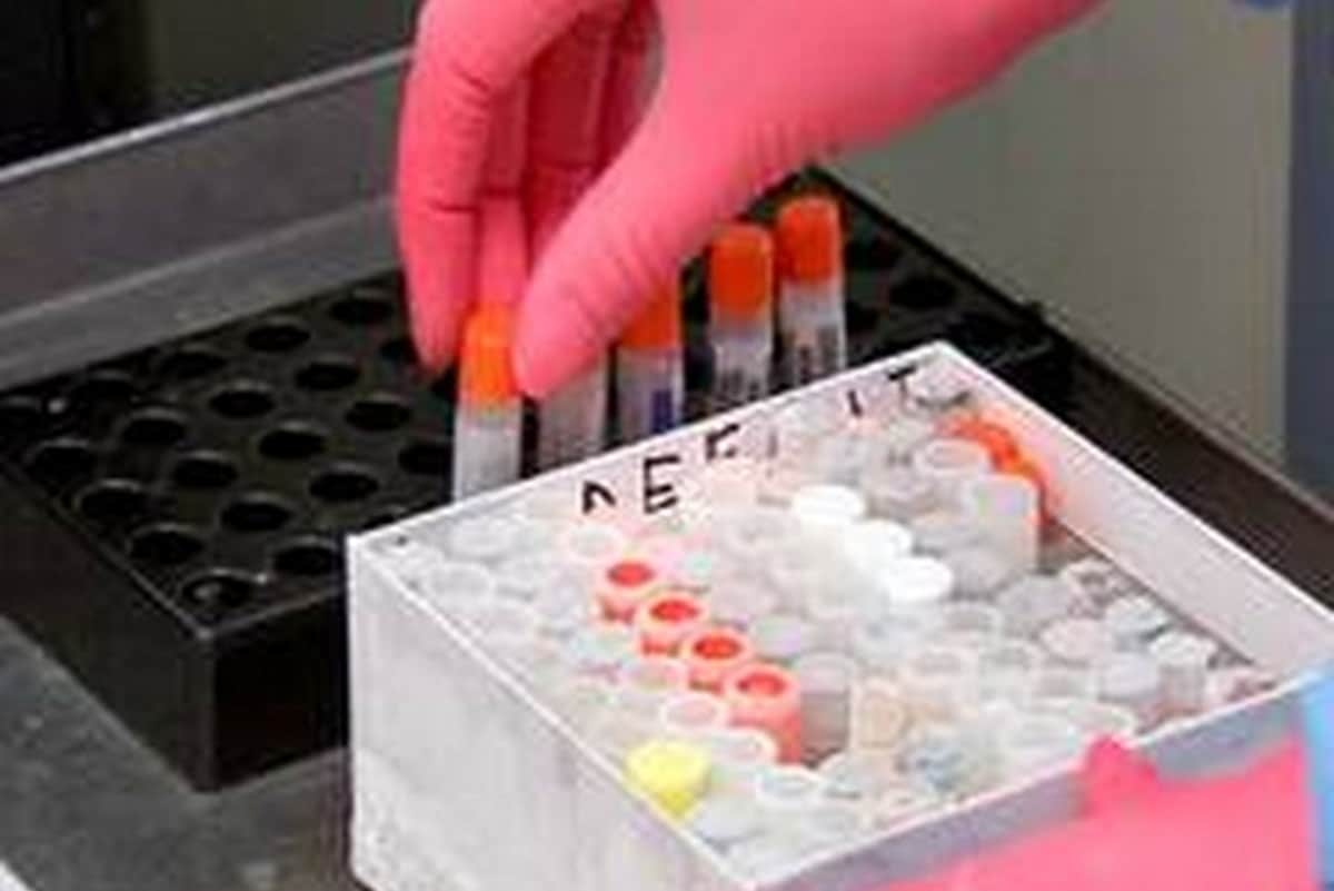 Coronavirus Patient get covid infection again four month after recovery in hongkong, first case of corona reinfection