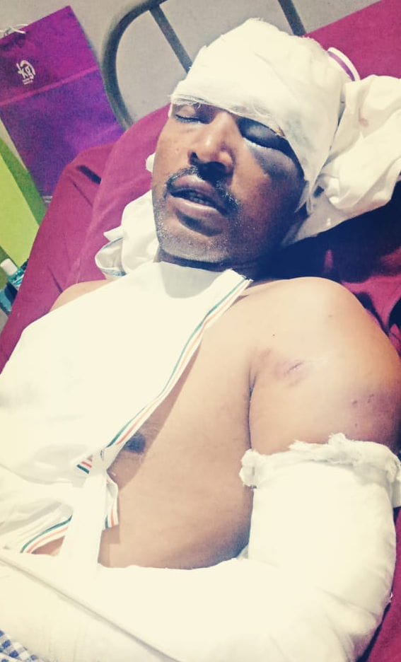 Teacher beaten up with sticks, condition critical