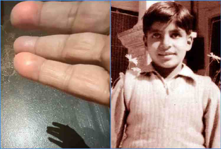 amitabh bachchan told story when his hand was injured during diwali