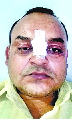 Deputy station superintendent's nose slit from Chinese manjhe