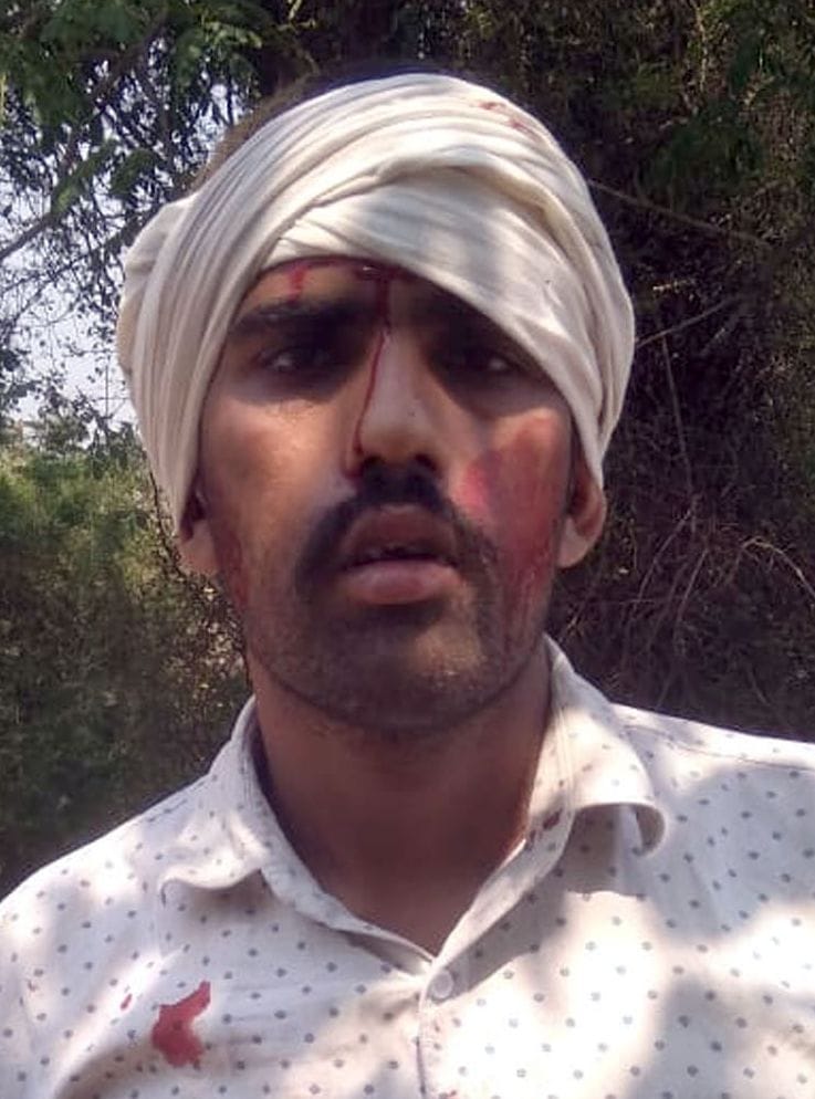 Attacked youth's head