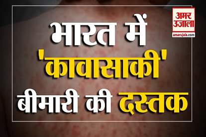 kawasaki disease in india between covid 19