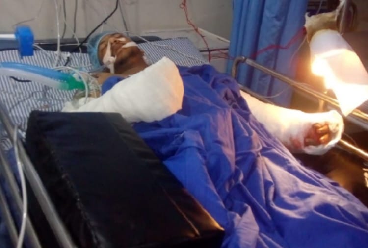 Attacked on a youth in Amritsar, hand chopped off