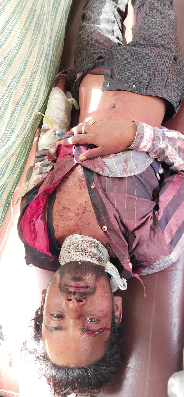 The youth was stabbed for refusing to park his bike
