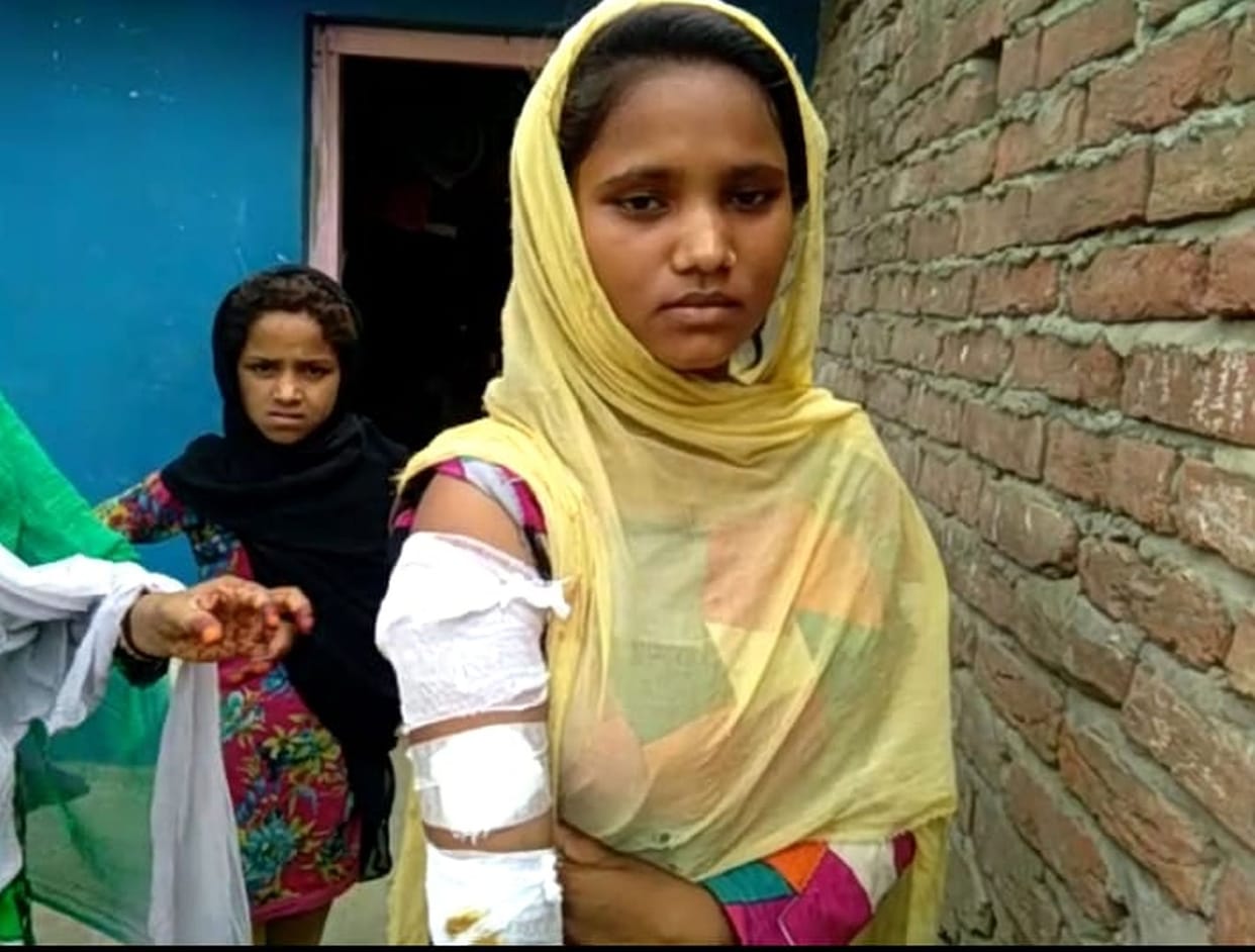 girls injured in  lepard attack