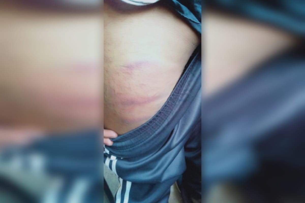 Police beat up international martial arts player in Saharanpur of Uttar Pradesh